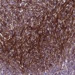EMILIN3 Polyclonal Antibody