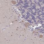 FEM1C Antibody in Immunohistochemistry (Paraffin) (IHC (P))