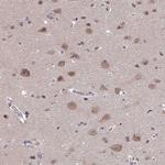 FEM1C Antibody in Immunohistochemistry (Paraffin) (IHC (P))