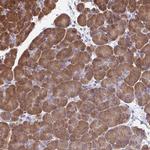 FEM1C Antibody in Immunohistochemistry (Paraffin) (IHC (P))