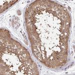 FEM1C Antibody in Immunohistochemistry (Paraffin) (IHC (P))