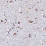 TMEM241 Polyclonal Antibody