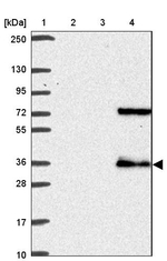 TMEM241 Antibody in Western Blot (WB)