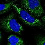 C1orf151 Polyclonal Antibody