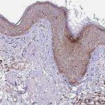 C1orf151 Antibody in Immunohistochemistry (Paraffin) (IHC (P))