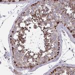 C1orf151 Antibody in Immunohistochemistry (Paraffin) (IHC (P))