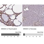 C1orf151 Antibody in Immunohistochemistry (IHC)
