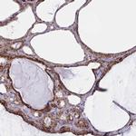 C1orf151 Antibody in Immunohistochemistry (IHC)