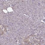 C1orf151 Antibody in Immunohistochemistry (IHC)