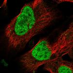 DLX4 Polyclonal Antibody