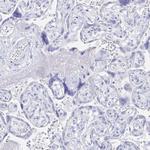 PRDM7 Polyclonal Antibody