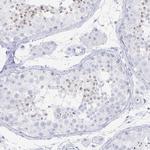 PRDM7 Antibody in Immunohistochemistry (Paraffin) (IHC (P))