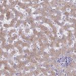 FAM122C Polyclonal Antibody