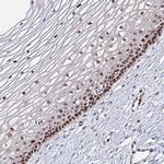 C19orf43 Antibody in Immunohistochemistry (Paraffin) (IHC (P))