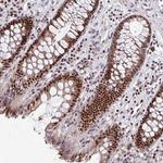 C19orf43 Antibody in Immunohistochemistry (Paraffin) (IHC (P))