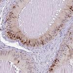 C19orf43 Antibody in Immunohistochemistry (Paraffin) (IHC (P))