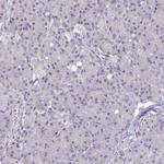 C19orf43 Antibody in Immunohistochemistry (Paraffin) (IHC (P))