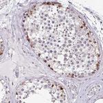 C19orf43 Antibody in Immunohistochemistry (Paraffin) (IHC (P))