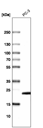 C19orf43 Antibody in Western Blot (WB)