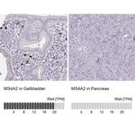MS4A2 Antibody in Immunohistochemistry (IHC)