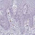MS4A2 Antibody in Immunohistochemistry (IHC)