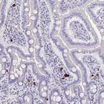 MS4A2 Antibody in Immunohistochemistry (IHC)