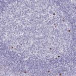 MS4A2 Antibody in Immunohistochemistry (IHC)
