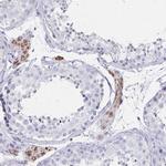 MS4A2 Antibody in Immunohistochemistry (IHC)