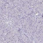 MS4A2 Antibody in Immunohistochemistry (IHC)