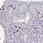 MS4A2 Antibody in Immunohistochemistry (IHC)
