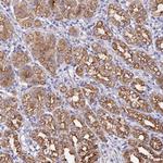 ZIK1 Antibody in Immunohistochemistry (Paraffin) (IHC (P))
