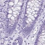 VGAT Antibody in Immunohistochemistry (IHC)
