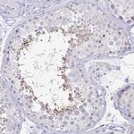 IRGC Polyclonal Antibody