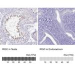 IRGC Antibody in Immunohistochemistry (IHC)