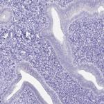 IRGC Antibody in Immunohistochemistry (IHC)