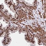 TBL1Y Antibody in Immunohistochemistry (Paraffin) (IHC (P))