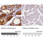 RAB43 Antibody in Immunohistochemistry (IHC)