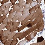 CLIC2 Polyclonal Antibody