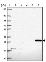 CLIC2 Antibody in Western Blot (WB)