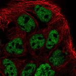 PROB1 Polyclonal Antibody