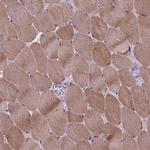 PROB1 Antibody in Immunohistochemistry (Paraffin) (IHC (P))