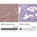 PROB1 Antibody in Immunohistochemistry (IHC)