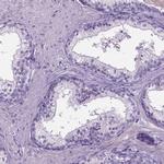 PROB1 Antibody in Immunohistochemistry (IHC)