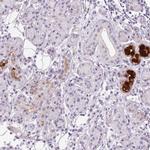 BPIL1 Antibody in Immunohistochemistry (IHC)