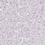 BPIL1 Antibody in Immunohistochemistry (IHC)