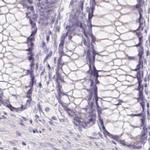 BPIL1 Antibody in Immunohistochemistry (IHC)