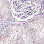 BPIL1 Antibody in Immunohistochemistry (IHC)