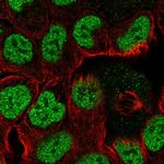 TPRG1 Polyclonal Antibody