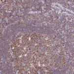 TPRG1 Antibody in Immunohistochemistry (Paraffin) (IHC (P))