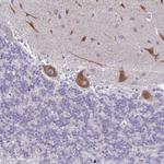 PITPNM1 Antibody in Immunohistochemistry (Paraffin) (IHC (P))